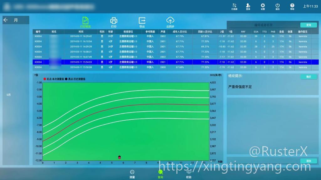 骨密度测量仪